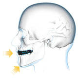 Shock Doctor Gel Max Flavour Fusion Blue Raspberry Mouth Guard Gum Shield